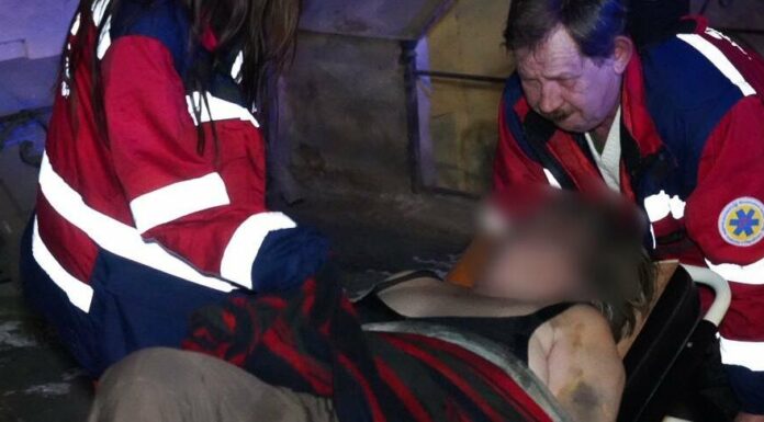 Пожежа в центрі Одеси: жінка отримала серйозні опіки, — ФОТО