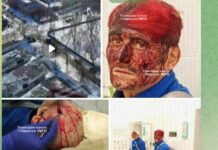 В Одесі чоловік після візиту до ТЦК потрапив до лікарні з травмою голови