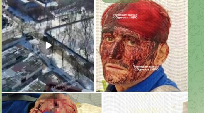 В Одесі чоловік після візиту до ТЦК потрапив до лікарні з травмою голови