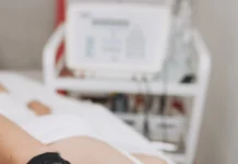 Небажане волосся на обличчі у жінок: причини появи та способи видалення