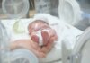 З 22 тижнів: як відбувається виходжування передчасно народжених дітей